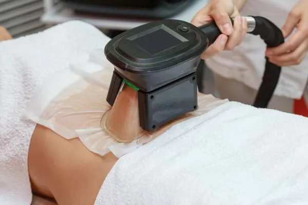 Image of person having fat freezing treatment to help weight gain Halesowen