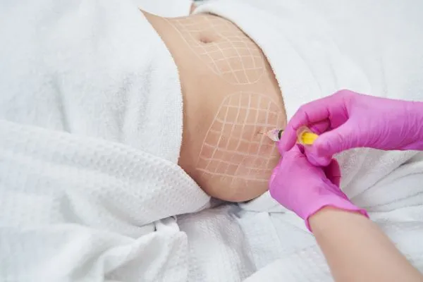 image of fat dissolving injections on love handles to help combat weight gain Halesowen
