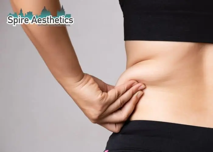 Image of woman pinching fat on their hips Halesowen. Fat Freezing treatment
